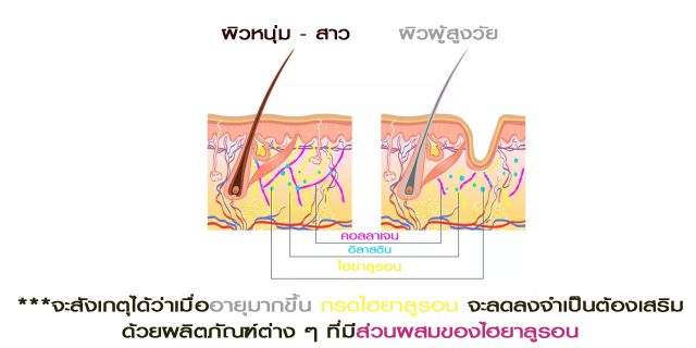 กรดไฮยาลูรอน