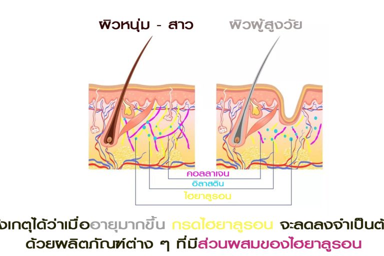 กรดไฮยาลูรอน